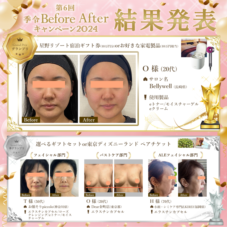 ビフォーアフター2